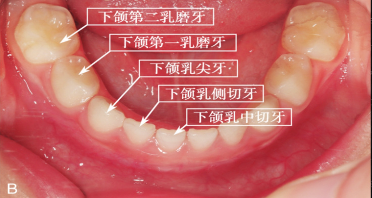  关注6个月到2岁半宝宝的乳牙发育 